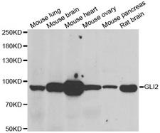 GLI2 Antibody - Western blot analysis of extracts of various  tissues.