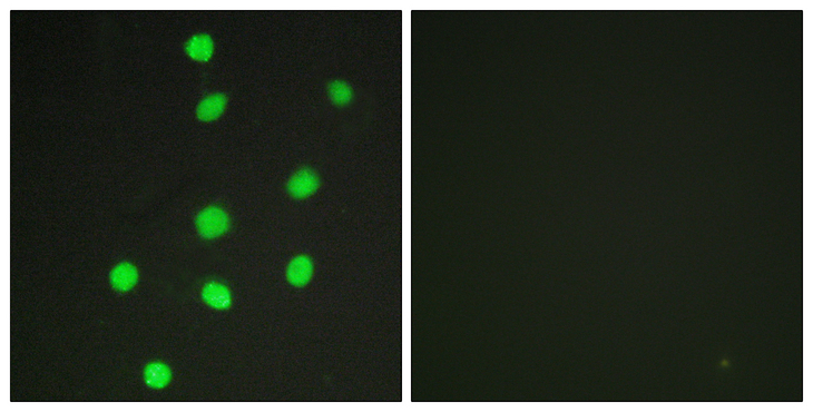 GLI3 Antibody - Immunofluorescence analysis of HepG2 cells, using GLI-3 Antibody. The picture on the right is blocked with the synthesized peptide.