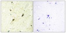 GLI3 Antibody - Immunohistochemistry analysis of paraffin-embedded human brain tissue, using GLI-3 Antibody. The picture on the right is blocked with the synthesized peptide.