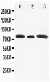 GLI3 Antibody - WB of GLI3 antibody. All lanes: Anti-GLI3 at 0.5ug/ml. Lane 1: Rat Testis Tissue Lysate at 40ug. Lane 2: A549 Whole Cell Lysate at 40ug. Lane 3: SW620 Whole Cell Lysate at 40ug. Predicted bind size: 170KD. Observed bind size: 80KD.