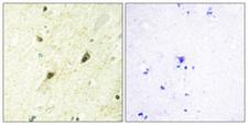 GLI3 Antibody - Peptide - + Immunohistochemistry analysis of paraffin-embedded human brain tissue, using GLI-3 antibody.