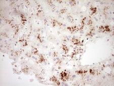 GLI4 Antibody - IHC of paraffin-embedded Human liver tissue using anti-GLI4 mouse monoclonal antibody. (Heat-induced epitope retrieval by 1 mM EDTA in 10mM Tris, pH8.5, 120°C for 3min).