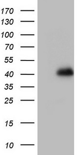 GLI4 Antibody - HEK293T cells were transfected with the pCMV6-ENTRY control. (Left lane) or pCMV6-ENTRY GLI4. (Right lane) cDNA for 48 hrs and lysed. Equivalent amounts of cell lysates. (5 ug per lane) were separated by SDS-PAGE and immunoblotted with anti-GLI4.