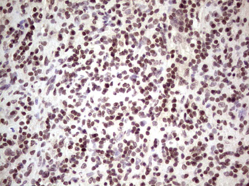 GLI4 Antibody - Immunohistochemical staining of paraffin-embedded Human lymph node tissue within the normal limits using anti-GLI4 mouse monoclonal antibody. (Heat-induced epitope retrieval by 1 mM EDTA in 10mM Tris, pH8.5, 120C for 3min,