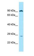 GLIPR1 / GLIPR Antibody - GLIPR1 / GLIPR antibody Western Blot of MCF7.  This image was taken for the unconjugated form of this product. Other forms have not been tested.
