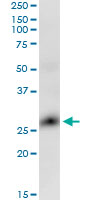 GLIPR1 / GLIPR Antibody - GLIPR1 monoclonal antibody (M04), clone 8D9. Western blot of GLIPR1 expression in HeLa.