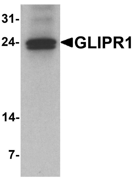 GLIPR1 / GLIPR Antibody - Western blot analysis of GLIPR1 in mouse small intestine tissue lysate with GLIPR1 antibody at 1 ug/ml.