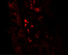 GLIPR1 / GLIPR Antibody - Immunoflorescence of GLIPR1 in human small intestine tissue with GLIPR1 antibody at 5 ug/mL.