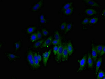 GLIPR1 / GLIPR Antibody - Immunofluorescent analysis of HepG2 cells using GLIPR1 Antibody at dilution of 1:100 and Alexa Fluor 488-congugated AffiniPure Goat Anti-Rabbit IgG(H+L)