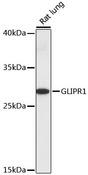 GLIPR1 / GLIPR Antibody - Western blot analysis of extracts of rat lung using GLIPR1 Polyclonal Antibody at dilution of 1:1000.