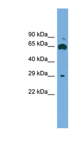 GLIPR1L1 Antibody - GLIPR1L1 antibody Western blot of ACHN lysate. This image was taken for the unconjugated form of this product. Other forms have not been tested.