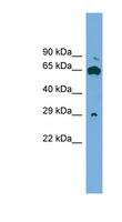 GLIPR1L1 Antibody - GLIPR1L1 antibody Western blot of ACHN lysate. This image was taken for the unconjugated form of this product. Other forms have not been tested.