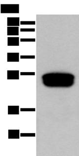 GLIPR1L1 Antibody - Western blot analysis of Human testis tissue  using GLIPR1L1 Polyclonal Antibody at dilution of 1:300