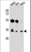 GLIPR1L2 Antibody - GLIPR1L2 Antibody western blot of K562,293,WiDr cell line lysates (35 ug/lane). The GLIPR1L2 antibody detected the GLIPR1L2 protein (arrow).