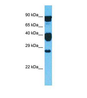 GLIPR1L2 Antibody - Western blot of Human HeLa. GLIPR1L2 antibody dilution 1.0 ug/ml.  This image was taken for the unconjugated form of this product. Other forms have not been tested.