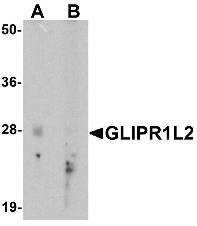 GLIPR1L2 Antibody - Western blot analysis of GLIPR1L2 in human testis tissue lysate with GLIPR1L2 antibody at 1 ug/ml in (A) the absence and (B) the presence of blocking peptide.