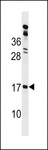 GLIPR2 Antibody - GAPR1 Antibody western blot of Y79 cell line lysates (35 ug/lane). The GAPR1 antibody detected the GAPR1 protein (arrow).