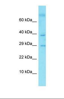 GLIPR2 Antibody - Western blot of Fetal Kidney. C9orf19 antibody dilution 1.0 ug/ml.  This image was taken for the unconjugated form of this product. Other forms have not been tested.