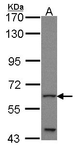 GLIS1 Antibody - Sample (30 ug of whole cell lysate). A: JurKat. 7.5% SDS PAGE. GLIS1 antibody diluted at 1:1000.