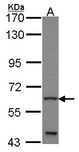 GLIS1 Antibody - Sample (30 ug of whole cell lysate). A: JurKat. 7.5% SDS PAGE. GLIS1 antibody diluted at 1:1000.