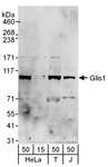 GLIS1 Antibody - Detection of Human Glis1 by Western Blot. Samples: Whole cell lysate from HeLa (15 and 50 ug), 293T (T; 50 ug) and Jurkat (J; 50 ug) cells. Antibodies: Affinity purified rabbit anti-Glis1 antibody used for WB at 1 ug/ml. Detection: Chemiluminescence with an exposure time of 3 minutes.