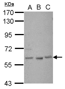 GLIS1 Antibody - Sample (30 ug of whole cell lysate) A: A549 B: H1299 C: MCF-7 7.5% SDS PAGE GLIS1 antibody diluted at 1:1000