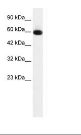 GLIS2 Antibody - HepG2 Cell Lysate.  This image was taken for the unconjugated form of this product. Other forms have not been tested.