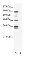 GLIS2 Antibody - A: Marker, B: HepG2 Cell Lysate.  This image was taken for the unconjugated form of this product. Other forms have not been tested.
