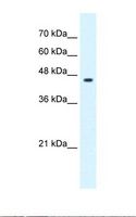 GLIS3 Antibody - Jurkat cell lysate. Antibody concentration: 0.25 ug/ml. Gel concentration: 12%.  This image was taken for the unconjugated form of this product. Other forms have not been tested.