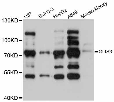 GLIS3 Antibody - Western blot analysis of extracts of various cell lines, using GLIS3 antibody at 1:3000 dilution. The secondary antibody used was an HRP Goat Anti-Rabbit IgG (H+L) at 1:10000 dilution. Lysates were loaded 25ug per lane and 3% nonfat dry milk in TBST was used for blocking. An ECL Kit was used for detection and the exposure time was 5s.