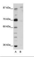 GLIS3 Antibody - A: Marker, B: HepG2 Cell Lysate.  This image was taken for the unconjugated form of this product. Other forms have not been tested.