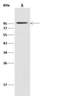 glk / Glucokinase Antibody - Anti-Influenza A H7N7 (A/Netherlands/219/03) Hemagglutinin / HA Protein rabbit polyclonal antibody at 1:1000 dilution. Lane A: HepG2 Whole Cell Lysate. Lysates/proteins at 30 ug per lane. Secondary: Goat Anti-Rabbit IgG (H+L)/HRP at 1/10000 dilution. Developed using the ECL technique. Performed under reducing conditions. Predicted band size: 92 kDa. Observed band size: 95 kDa.