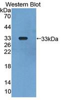 GLMN Antibody - Western blot of GLMN antibody.