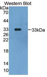GLMN Antibody - Western blot of GLMN antibody.