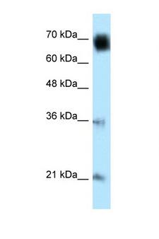 GLMN Antibody - GLMN antibody Western blot of HeLa Cell lysate. Antibody concentration 1 ug/ml. This image was taken for the unconjugated form of this product. Other forms have not been tested.