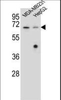 GLMN Antibody - GLMN Antibody western blot of MDA-MB231,HepG2 cell line lysates (35 ug/lane). The GLMN antibody detected the GLMN protein (arrow).