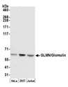 GLMN Antibody - Detection of human GLMN/Glomulin by western blot. Samples: Whole cell lysate (50 µg) from HeLa, HEK293T, and Jurkat cells prepared using NETN lysis buffer. Antibody: Affinity purified rabbit anti-GLMN/Glomulin antibody used for WB at 0.1 µg/ml. Detection: Chemiluminescence with an exposure time of 30 seconds.