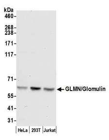 GLMN Antibody - Detection of human GLMN/Glomulin by western blot. Samples: Whole cell lysate (50 µg) from HeLa, HEK293T, and Jurkat cells prepared using NETN lysis buffer. Antibody: Affinity purified rabbit anti-GLMN/Glomulin antibody used for WB at 0.1 µg/ml. Detection: Chemiluminescence with an exposure time of 30 seconds.