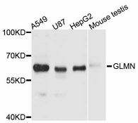 GLMN Antibody - Western blot analysis of extracts of various cell lines, using GLMN antibody at 1:3000 dilution. The secondary antibody used was an HRP Goat Anti-Rabbit IgG (H+L) at 1:10000 dilution. Lysates were loaded 25ug per lane and 3% nonfat dry milk in TBST was used for blocking. An ECL Kit was used for detection and the exposure time was 10s.