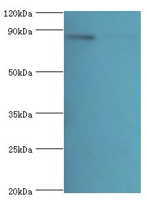 GLNRS / QARS Antibody - Western blot. All lanes: Glutamine--tRNA ligase antibody at 2 ug/ml. Lane 1: PC-3 whole cell lysate. Lane 2: HeLa whole cell lysate. Secondary antibody: Goat polyclonal to rabbit at 1:10000 dilution. Predicted band size: 88 kDa. Observed band size: 88 kDa Immunohistochemistry.