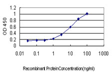 GLNRS / QARS Antibody - Detection limit for recombinant GST tagged QARS is approximately 1 ng/ml as a capture antibody.
