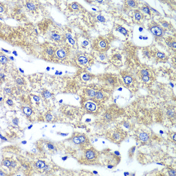 GLNRS / QARS Antibody - Immunohistochemistry of paraffin-embedded human liver injury tissue.