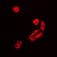 GLNRS / QARS Antibody - Immunofluorescent analysis of GlnRS staining in U2OS cells. Formalin-fixed cells were permeabilized with 0.1% Triton X-100 in TBS for 5-10 minutes and blocked with 3% BSA-PBS for 30 minutes at room temperature. Cells were probed with the primary antibody in 3% BSA-PBS and incubated overnight at 4 deg C in a humidified chamber. Cells were washed with PBST and incubated with a DyLight 594-conjugated secondary antibody (red) in PBS at room temperature in the dark.