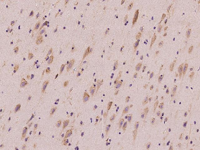 GLNRS / QARS Antibody - Immunochemical staining of human QARS in human brain with rabbit polyclonal antibody at 1:100 dilution, formalin-fixed paraffin embedded sections.