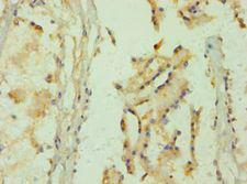 GLO1 / Glyoxalase I Antibody - Immunohistochemistry of paraffin-embedded human prostate tissue using antibody at 1:100 dilution.