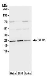 GLO1 / Glyoxalase I Antibody - Detection of human GLO1/Glyoxalase I by western blot. Samples: Whole cell lysate (50 µg) from HeLa, HEK293T, and Jurkat cells prepared using NETN lysis buffer. Antibody: Affinity purified rabbit anti-GLO1/Glyoxalase Iantibody used for WB at 0.1 µg/ml. Detection: Chemiluminescence with an exposure time of 1 second.