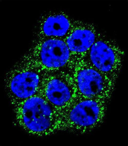 GLO1 / Glyoxalase I Antibody - Confocal immunofluorescence of GLO1 Antibody with WiDr cell followed by Alexa Fluor 488-conjugated goat anti-rabbit lgG (green). DAPI was used to stain the cell nuclear (blue).