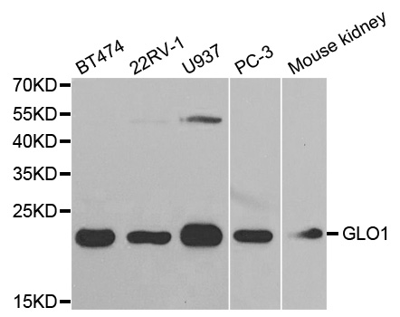 GLO1 / Glyoxalase I Antibody - Western blot analysis of extracts of various cell lines.