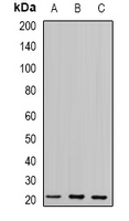 GLO1 / Glyoxalase I Antibody - Western blot analysis of Glyoxalase I expression in 22RV1 (A); PC3 (B); mouse kidney (C) whole cell lysates.