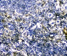 GLO1 / Glyoxalase I Antibody - IHC analysis of GLO1 using anti-GLO1 antibody. GLO1 was detected in paraffin-embedded section of mouse spleen tissues. Heat mediated antigen retrieval was performed in citrate buffer (pH6, epitope retrieval solution) for 20 mins. The tissue section was blocked with 10% goat serum. The tissue section was then incubated with 1µg/ml rabbit anti-GLO1 Antibody overnight at 4°C. Biotinylated goat anti-rabbit IgG was used as secondary antibody and incubated for 30 minutes at 37°C. The tissue section was developed using Strepavidin-Biotin-Complex (SABC) with DAB as the chromogen.